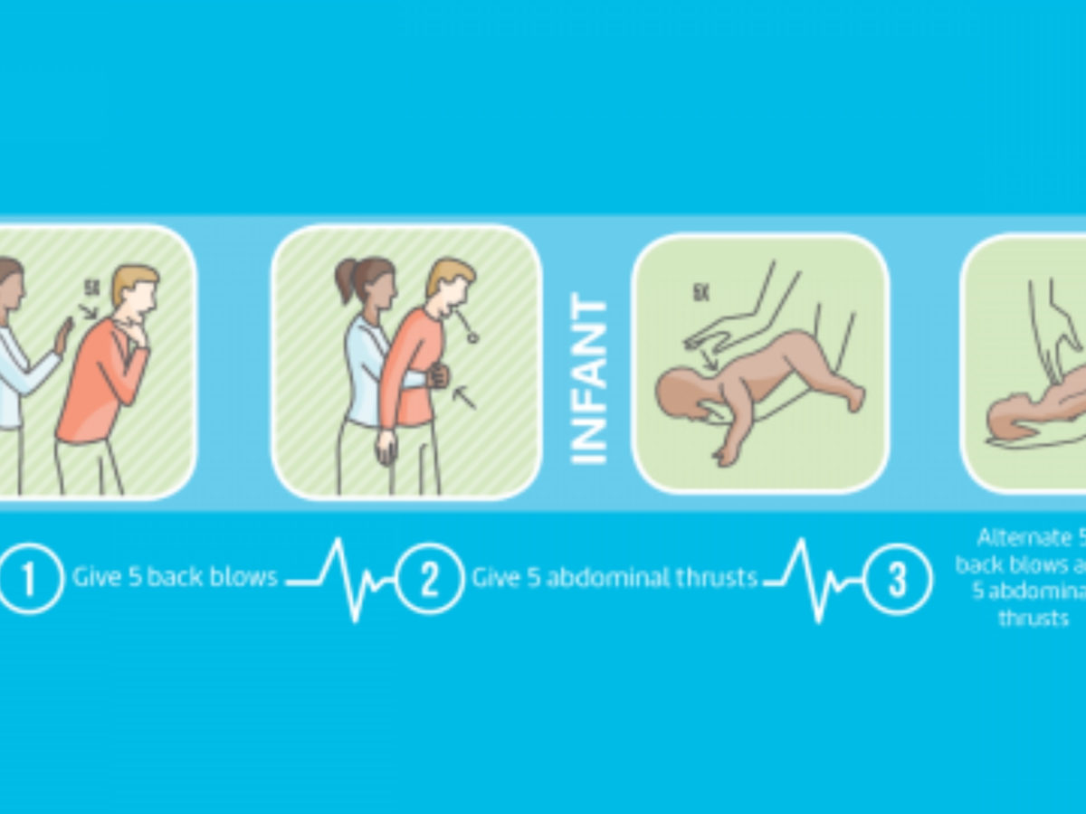 The Right Steps to Take If Someone Is Choking